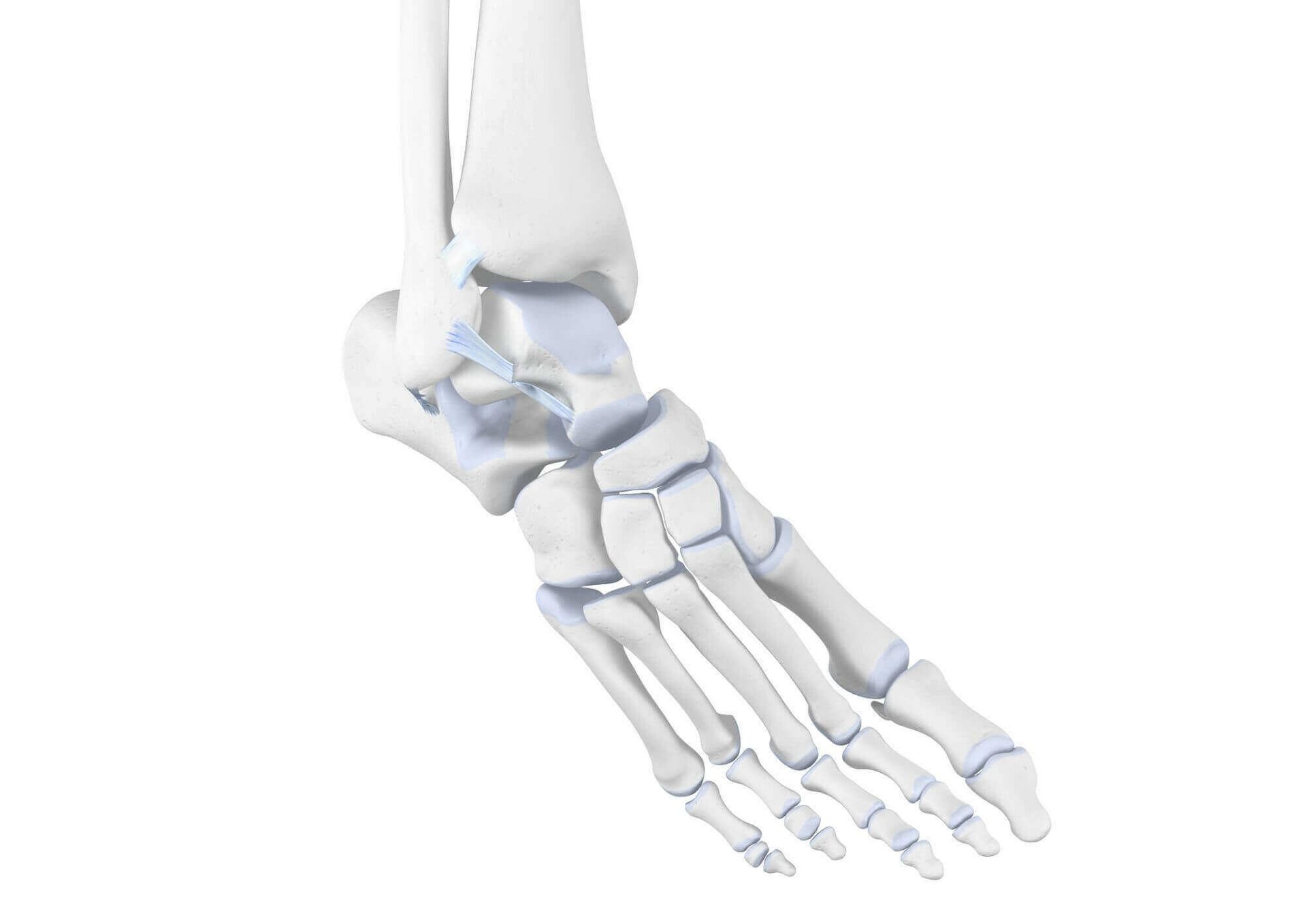 Darstellung der Anatomie des Sprunggelenks bei einem Supinationstrauma. Bei einem Supinationstrauma kann es zu Überdehnungen der Außenbänder des Fußes, Bänderrissen oder sogar Verletzungen des Knochens kommen.