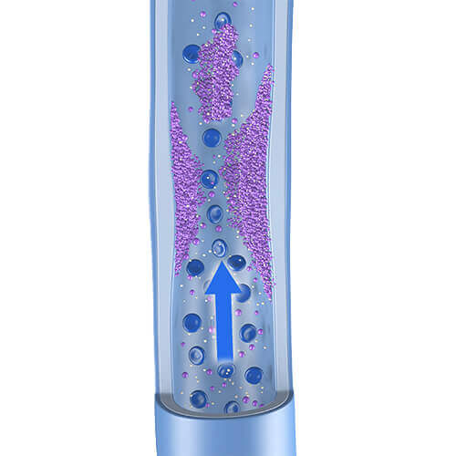 Illustration einer Vene mit einem postthrombotischen Syndrom. Das postthrombotische Syndrom ist fast immer die Folge einer tiefen Beinvenenthrombose.